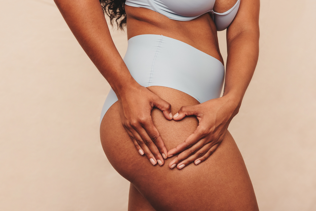 Cellulite: Causes, Prevention And Treatment