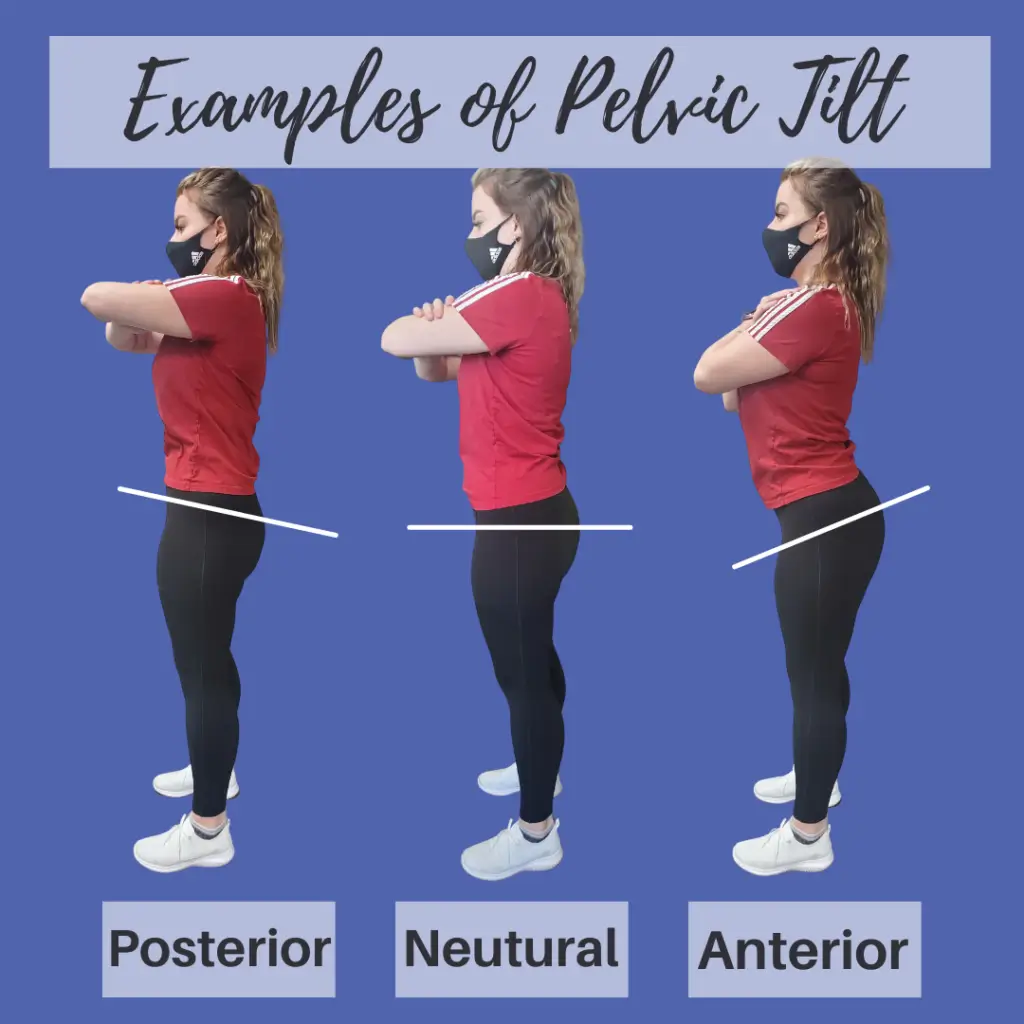 Do You Have A Pelvic Tilt?